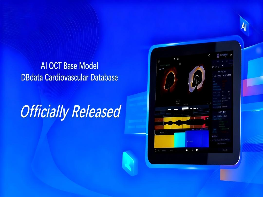 ¡No seguimos, definimos! La imagen intravascular en China entra en su era 